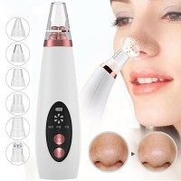 Blackheads Remover
